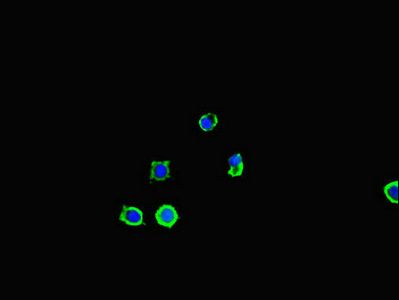 SQSTM1 Antibody
