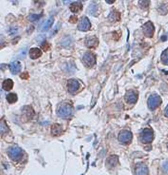 SR-B1 Rabbit Polyclonal Antibody