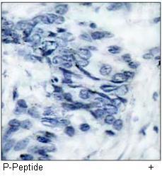 Src (Phospho-Tyr529) Antibody