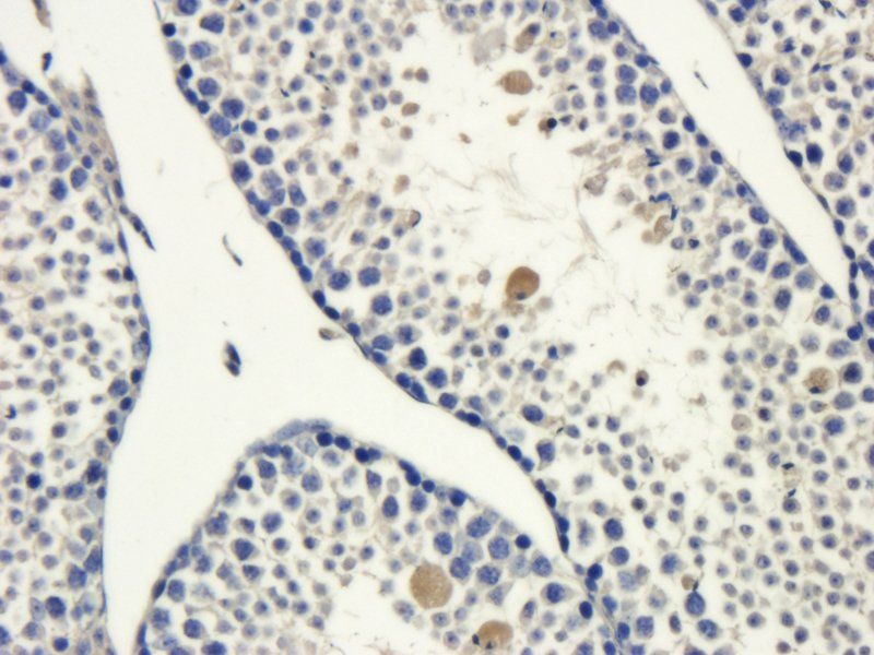 SRD5A2 Rabbit Polyclonal Antibody