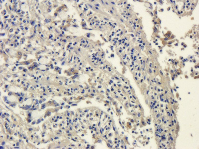 SRD5A2 Rabbit Polyclonal Antibody
