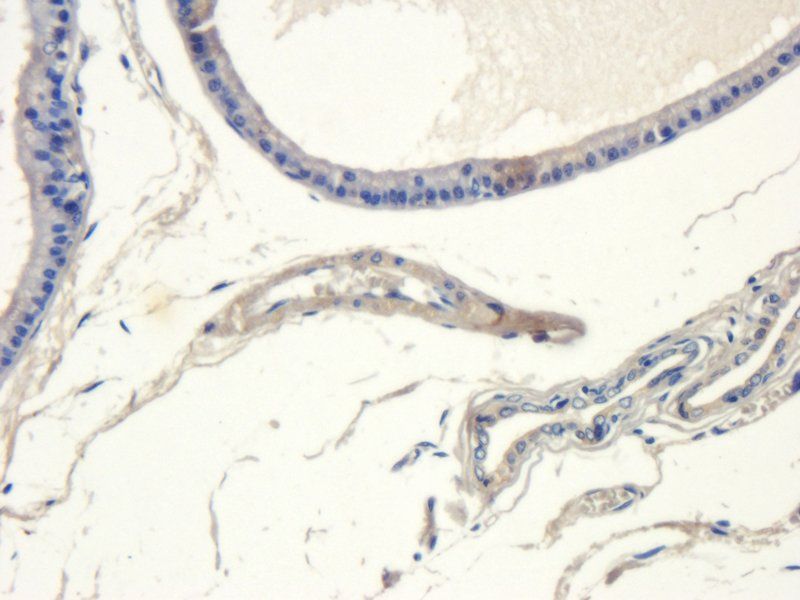SRD5A2 Rabbit Polyclonal Antibody