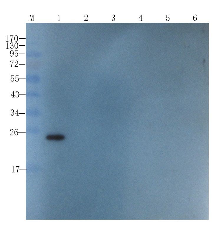 SRD5A2 Rabbit Polyclonal Antibody