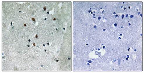 SRF (Phospho-Ser77) Antibody