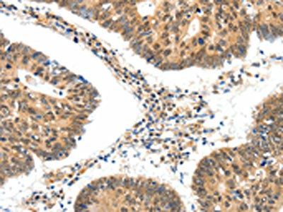 SSTR5 Antibody