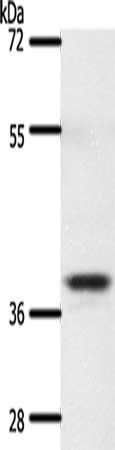 SSTR5 Antibody