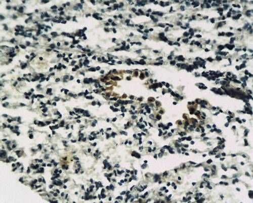 Somatostatin Receptor 5 Rabbit Polyclonal Antibody