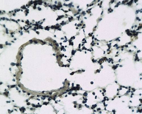 Somatostatin Receptor 5 Rabbit Polyclonal Antibody