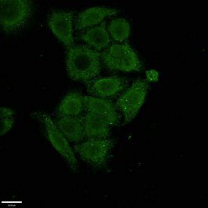 SSX1 Antibody