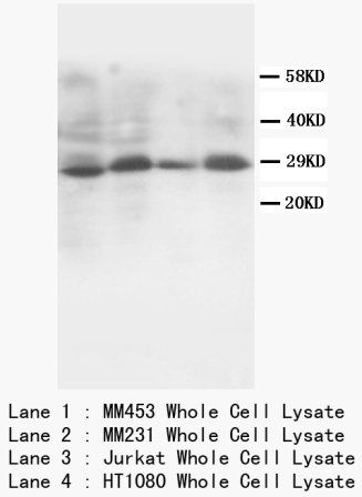 Protein SSX2 SSX2 Rabbit Polyclonal Antibody