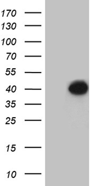 SSX2IP Antibody