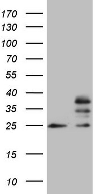 SSX2IP Antibody