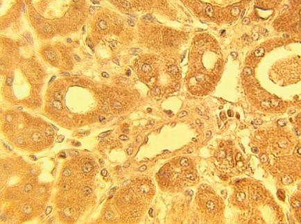 Rabbit anti Human Stanniocalcin-1 (STC1) Antibody