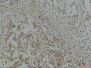 STAT1 Antibody