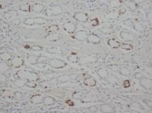 STAT1 Rabbit Polyclonal Antibody