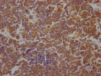 STAT3 Antibody