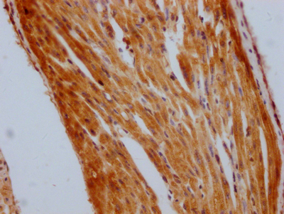 STAT3 Antibody