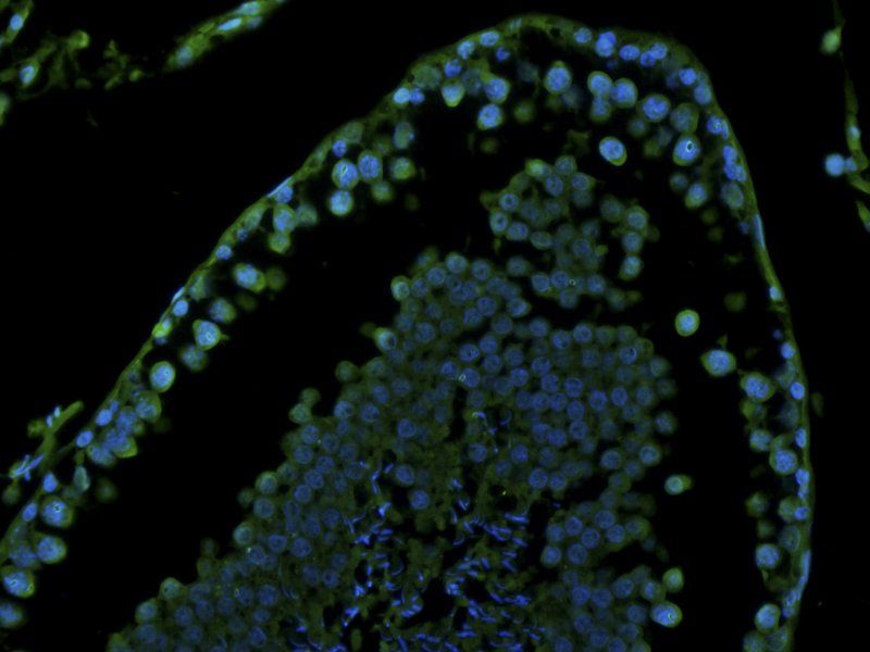 Stathmin Rabbit Polyclonal Antibody (FITC)