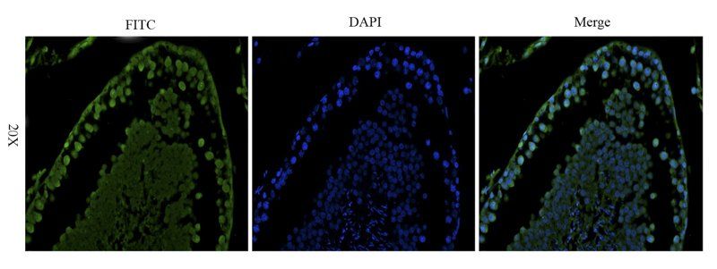 Stathmin Rabbit Polyclonal Antibody (FITC)