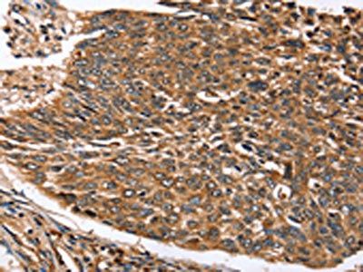STC1 Antibody