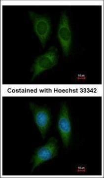 STK25 Rabbit Polyclonal Antibody