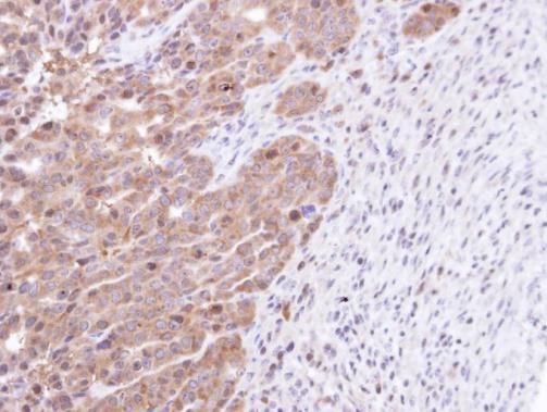 STK25 Rabbit Polyclonal Antibody