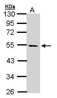 STK25 Rabbit Polyclonal Antibody