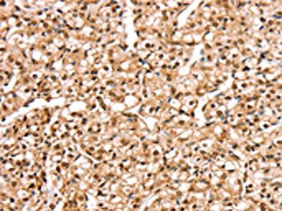 STK32B Antibody