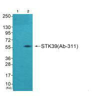 STK39 Antibody