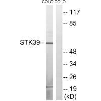 STK39 Antibody