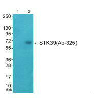 STK39 Antibody