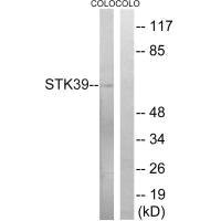 STK39 Antibody