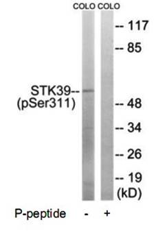 STK39 (Phospho-Ser311) Antibody