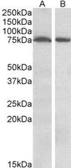 STK39/SPAK Antibody