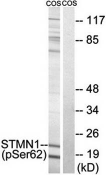 STMN1 (Phospho-Ser62) Antibody