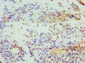 STOM Antibody