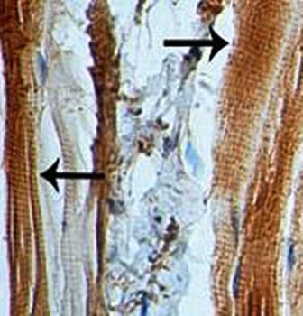 STUB1 Rabbit Polyclonal Antibody