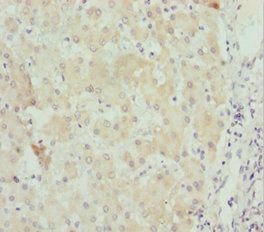 STXBP2 Antibody