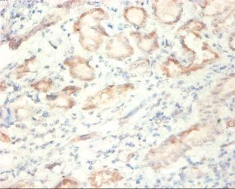 SDHA Antibody
