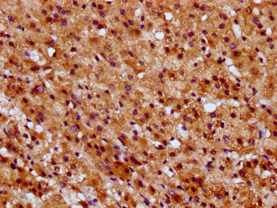 SUCLG1 Antibody