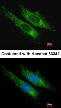 succinate-CoA ligase, GDP-forming beta subunit precursor antibody