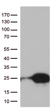 SUGT1 Antibody