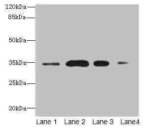 SLC38A2 Antibody Blocking Peptide