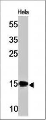 SUMO2 Antibody