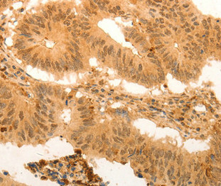 SUMO2 Antibody