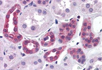 FACT/SUPT16H Antibody