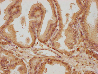 SUPV3L1 Antibody