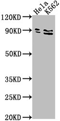 SUPV3L1 Antibody