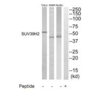 SUV39H2 Antibody
