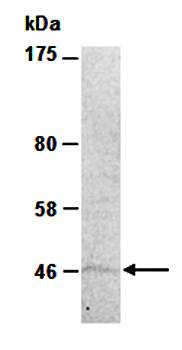 SUV39H2 (N) Antibody, Rabbit Polyclonal